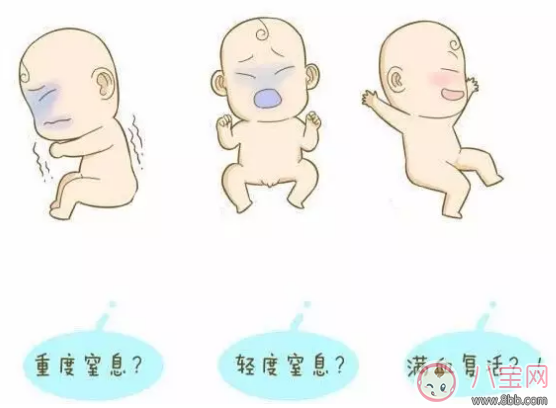 生產(chǎn)后的寶寶出生后去哪了    寶寶出生后就被抱走是為什么