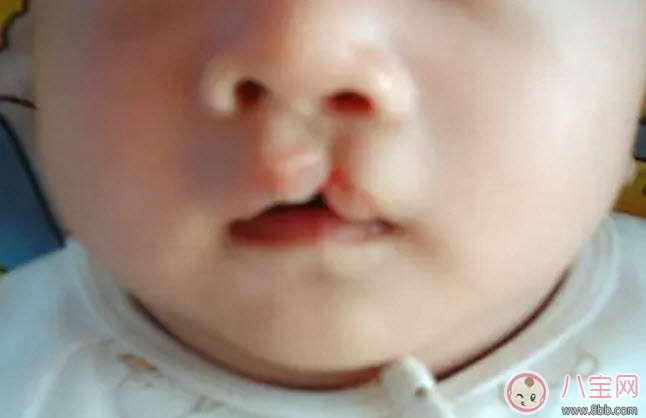 孕婦能吃兔肉嗎 孕婦吃兔肉對寶寶有什么好處
