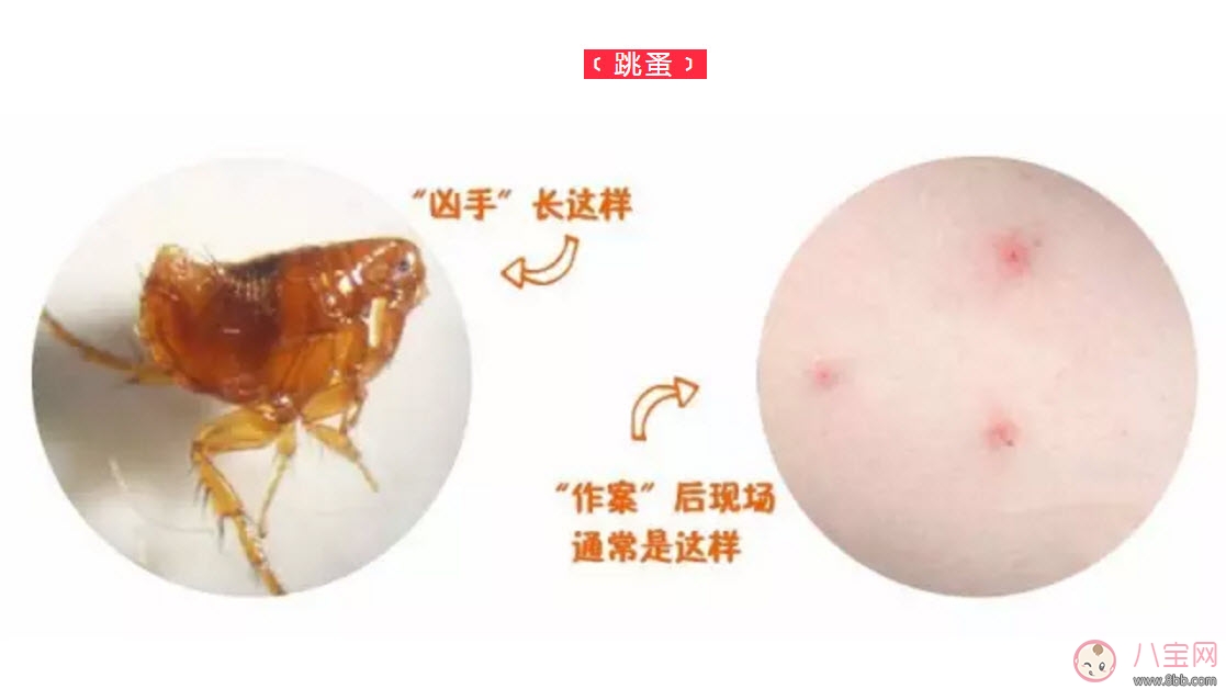 寶寶被跳蚤咬了癥狀圖片 寶寶被跳蚤咬和蚊子咬癥狀對比圖片區別
