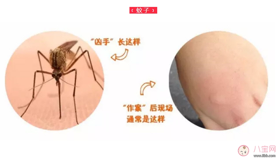 寶寶被臭蟲咬了癥狀圖片 寶寶被臭蟲咬和蚊子咬癥狀對比圖片區別