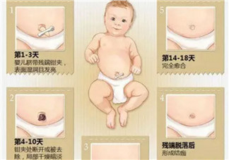 新生兒臍帶脫落的時(shí)間是幾天 新生兒臍帶脫落的過(guò)程圖解
