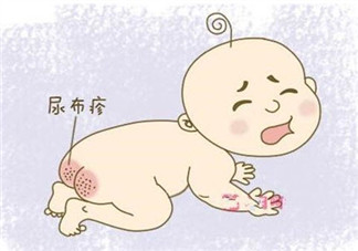 嬰兒長尿布疹怎么辦 尿布疹是怎么引起的