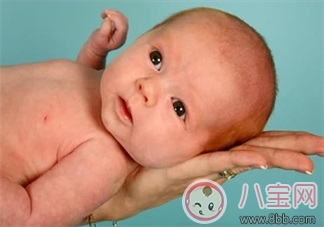 嬰兒常見皮膚問題怎么解決     尿布疹濕疹乳痂解決方法