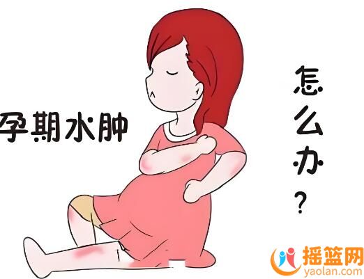 孕晚期水腫嚴重，這些方法也能幫助緩解！