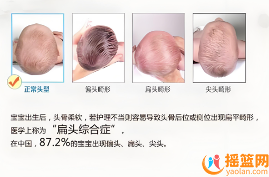 寶寶后腦勺扁平？如何將頭變圓呢？