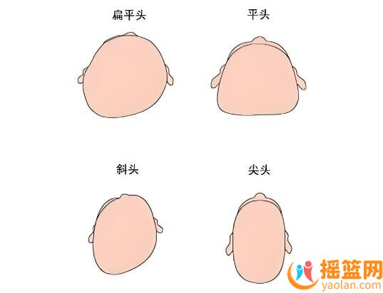 寶寶頭型養成，如何科學地塑造理想頭型？