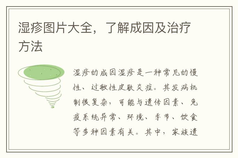 濕疹圖片大全，了解成因及治療方法