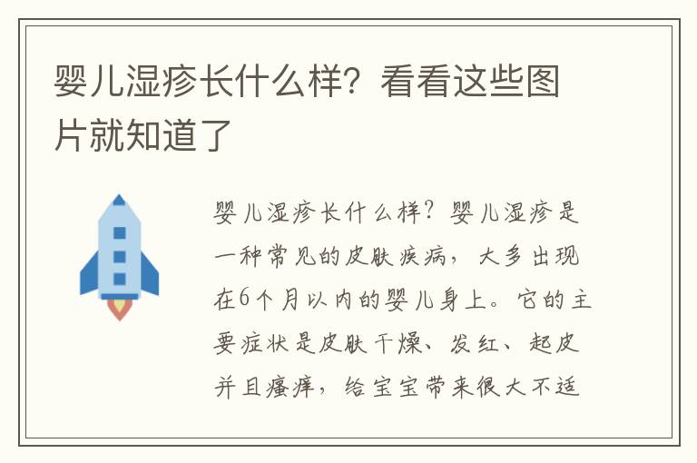 嬰兒濕疹長什么樣？看看這些圖片就知道了